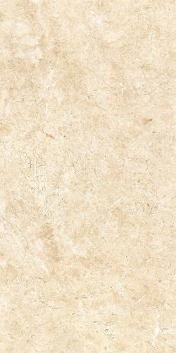 HYATT BOTTICINO TILE 1
